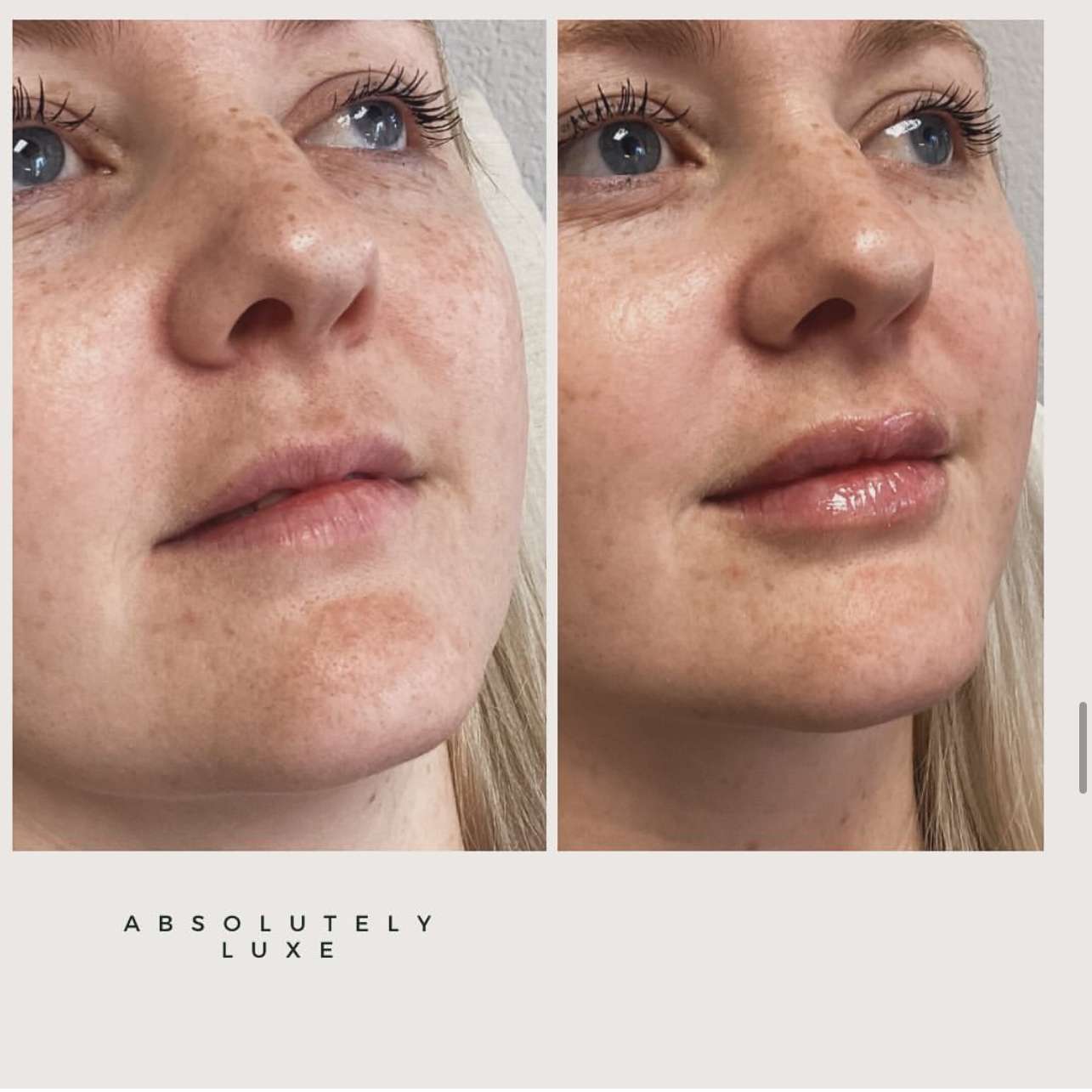 Napa solano medispa (98) foto