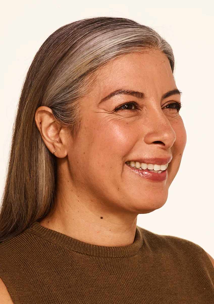 BOTOX before and after results at Deluxe Med Spa