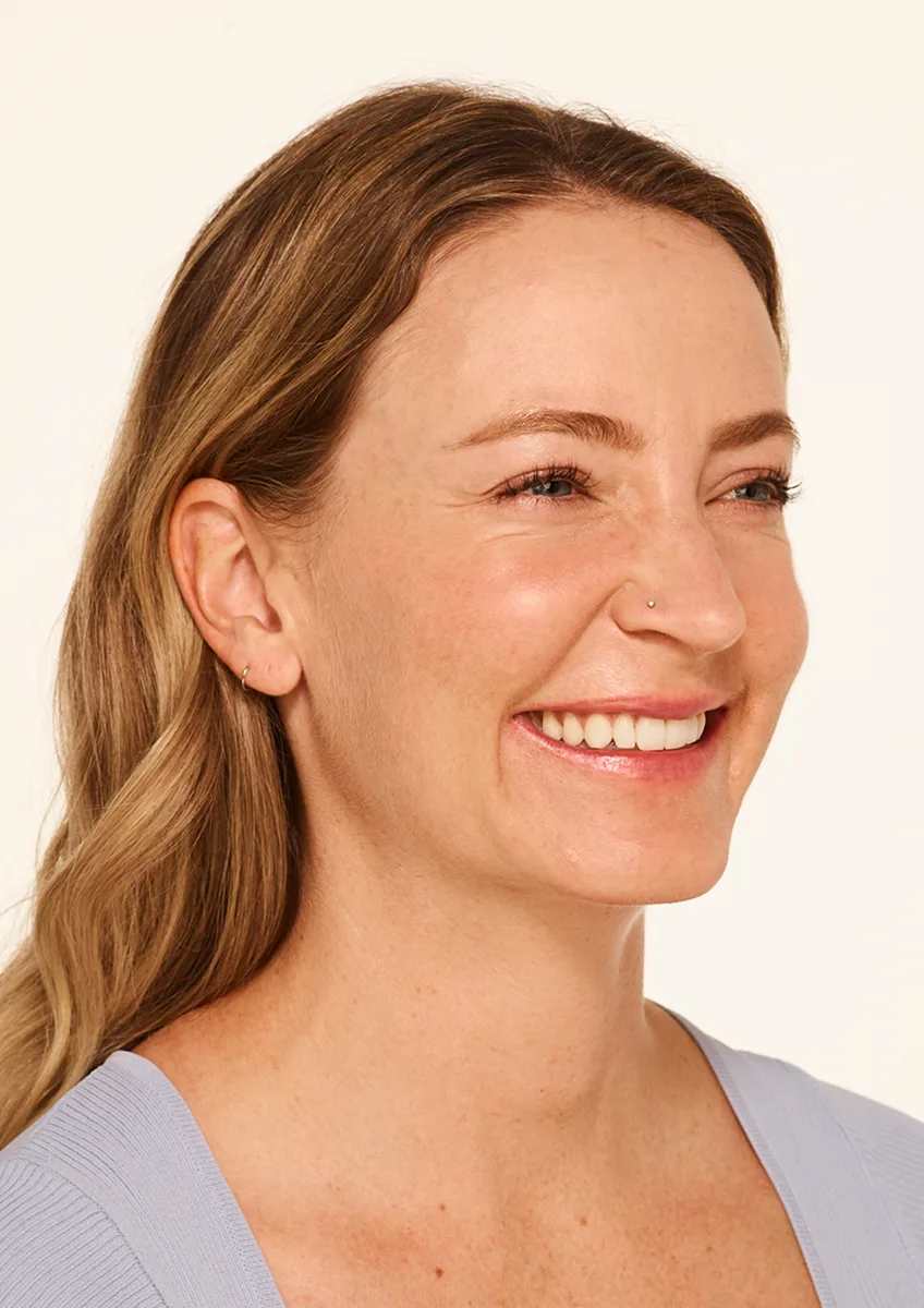 BOTOX before and after results at Deluxe Med Spa
