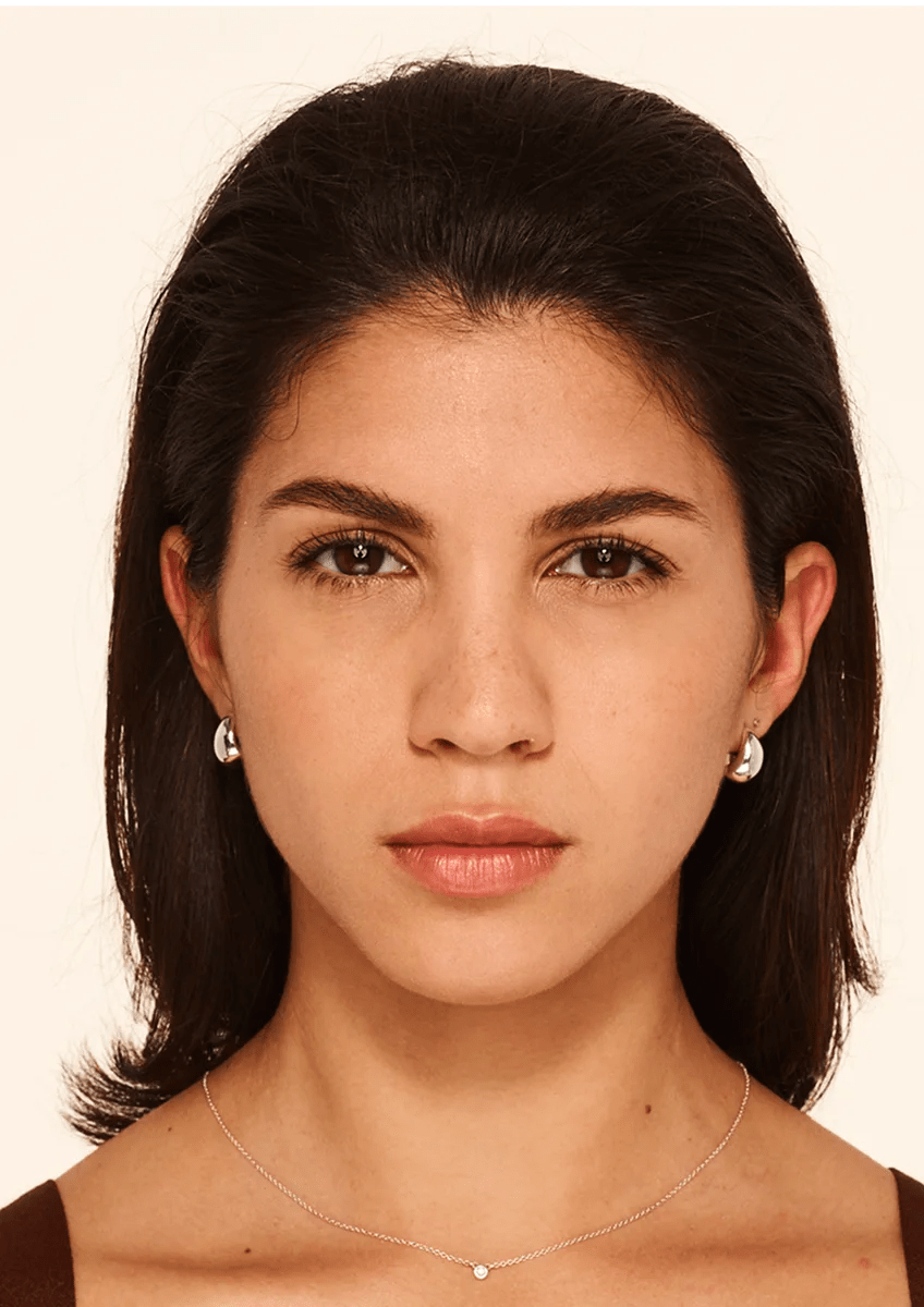 Nicole after treatment