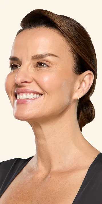 Botox neck and jaw after - Ana