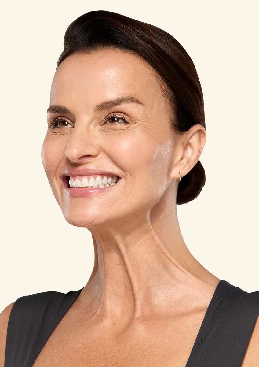 Botox neck and jaw before - Ana
