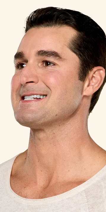 Botox neck and jaw after - Ben