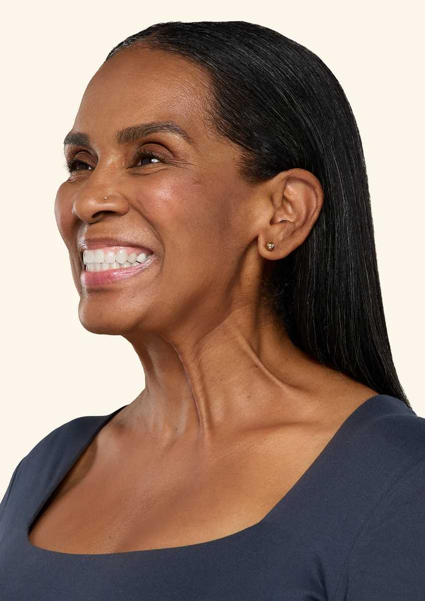 Botox neck and jaw before - Devonna