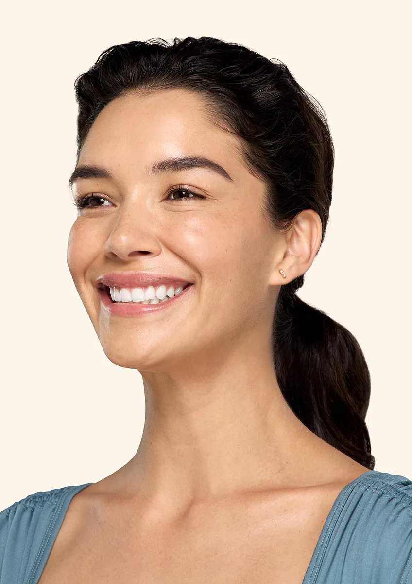 Botox neck and jaw after - Vanessa