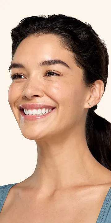 Botox neck and jaw after - Vanessa