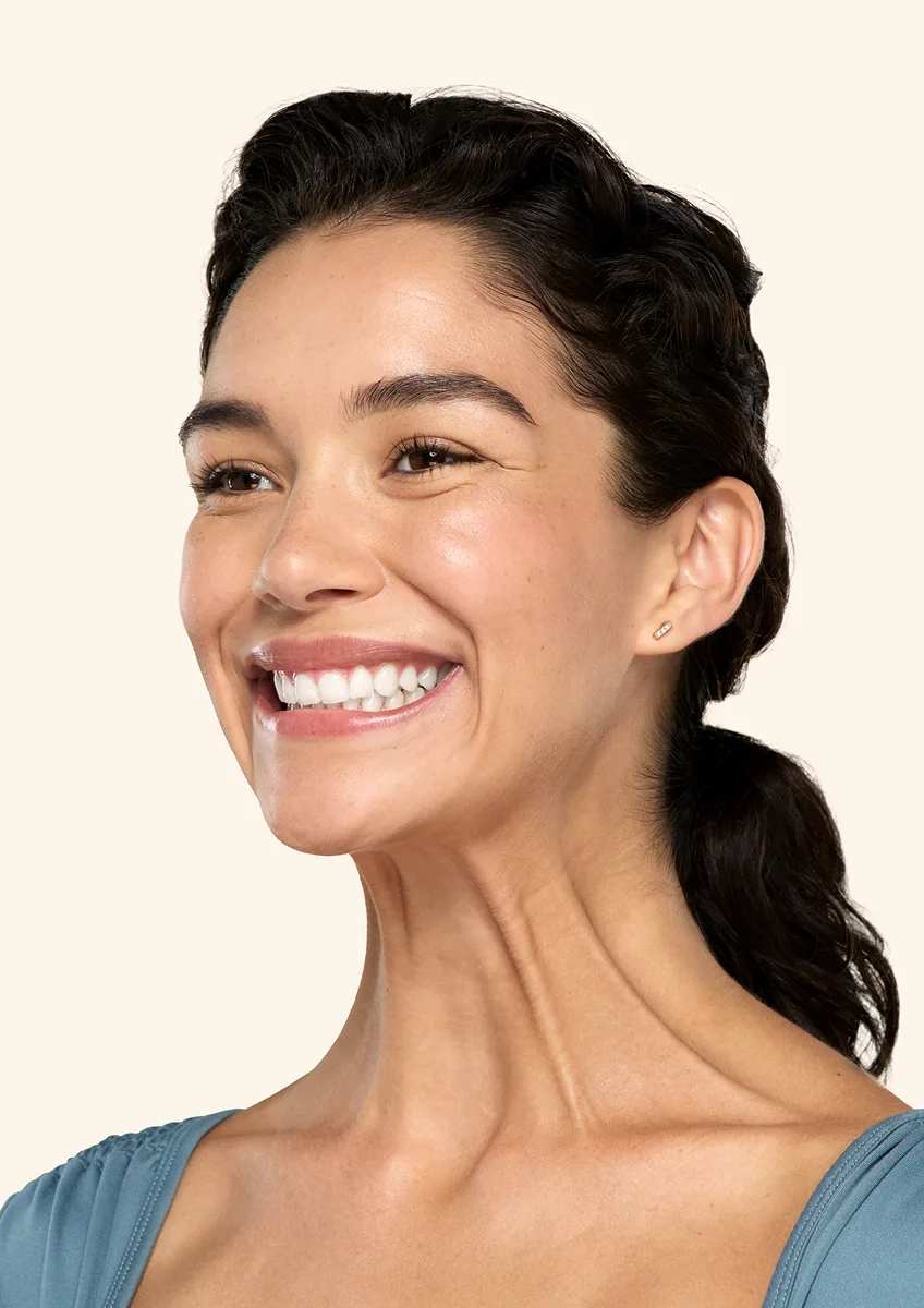 Botox neck and jaw before - Vanessa