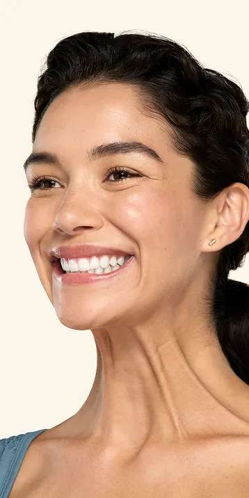 Botox neck and jaw before - Vanessa
