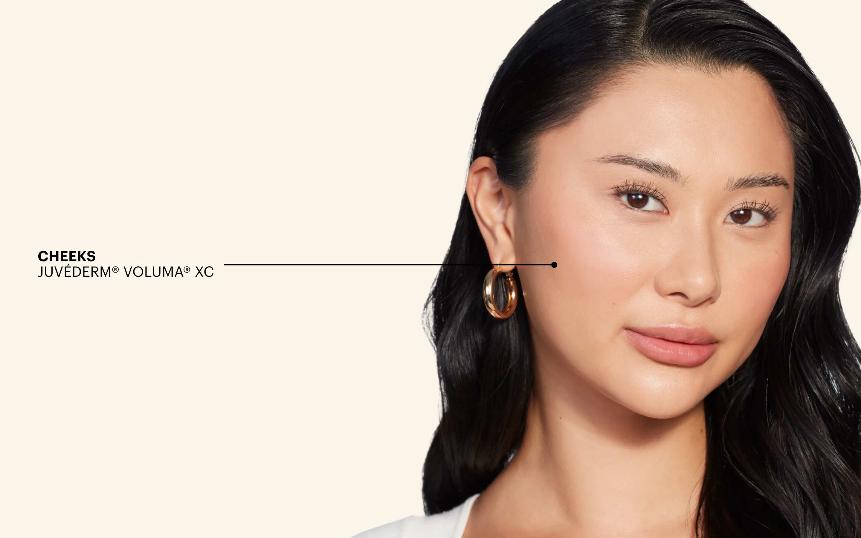 Juvederm Cheeks Hero