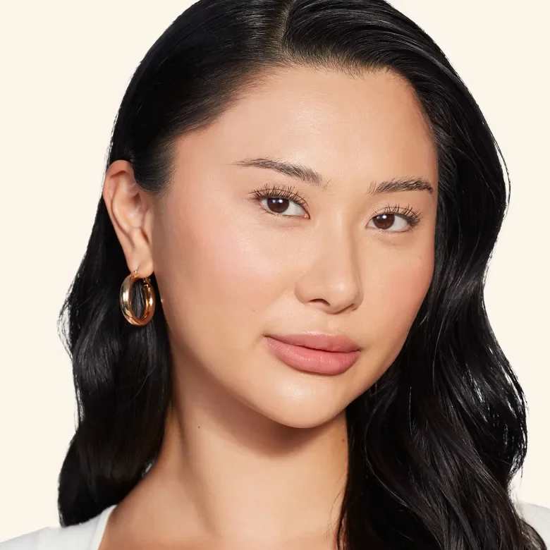 Juvederm Cheeks Hero