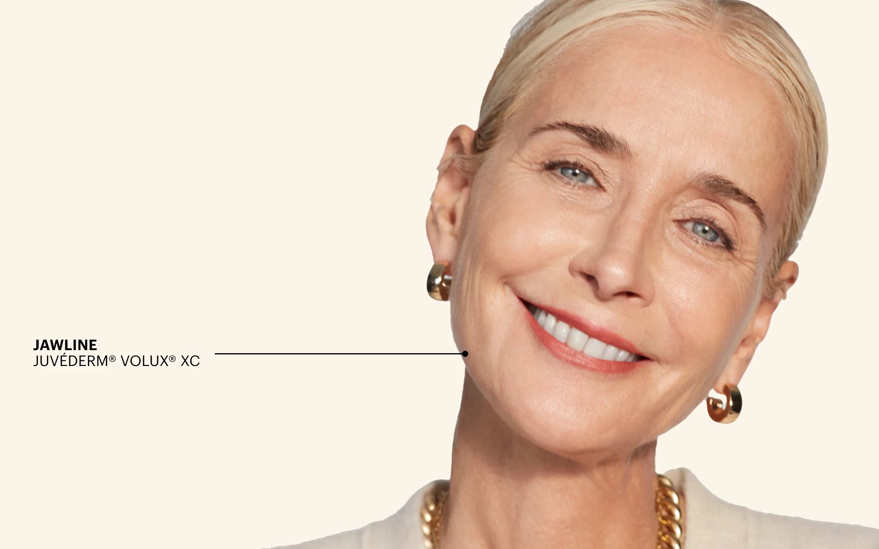 JUVÉDERM® Jawline Filler Hero