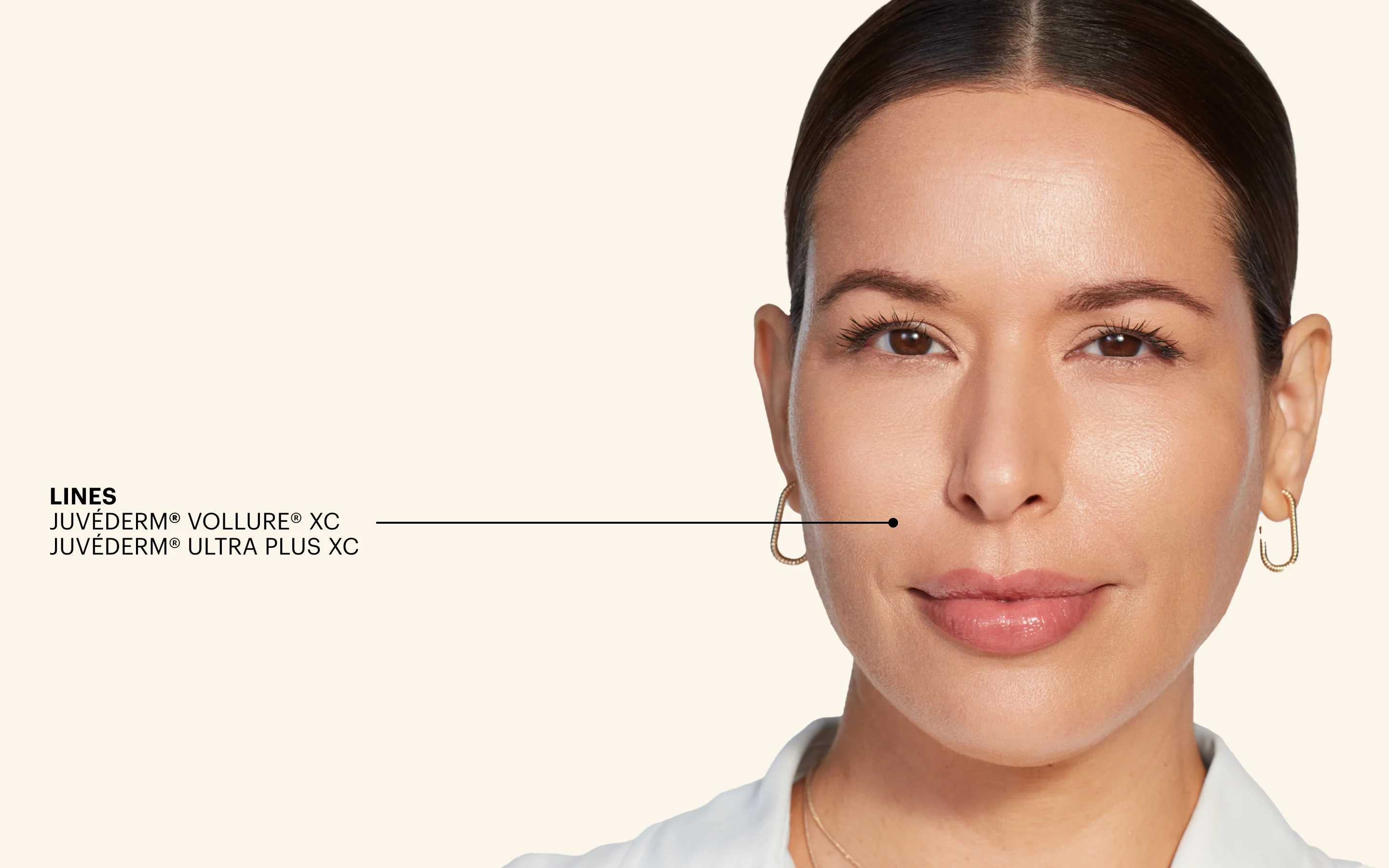 Juvederm Smile Lines Hero