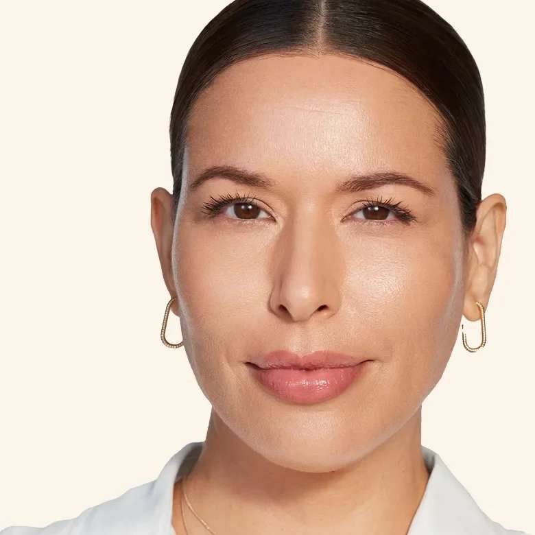 Juvederm Smile Lines Hero