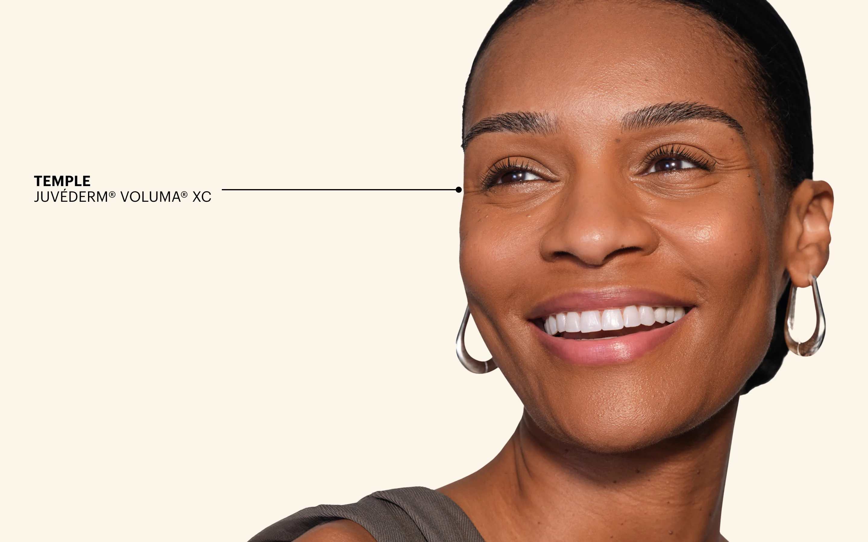 JUVÉDERM® Temple Filler Hero