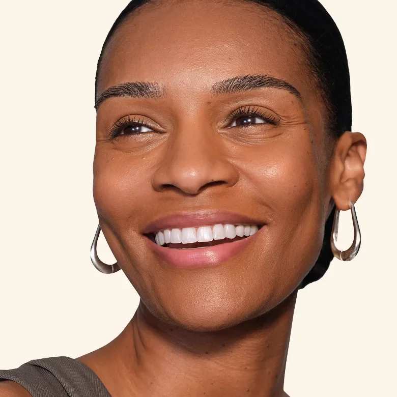 JUVÉDERM® Temple Filler Hero