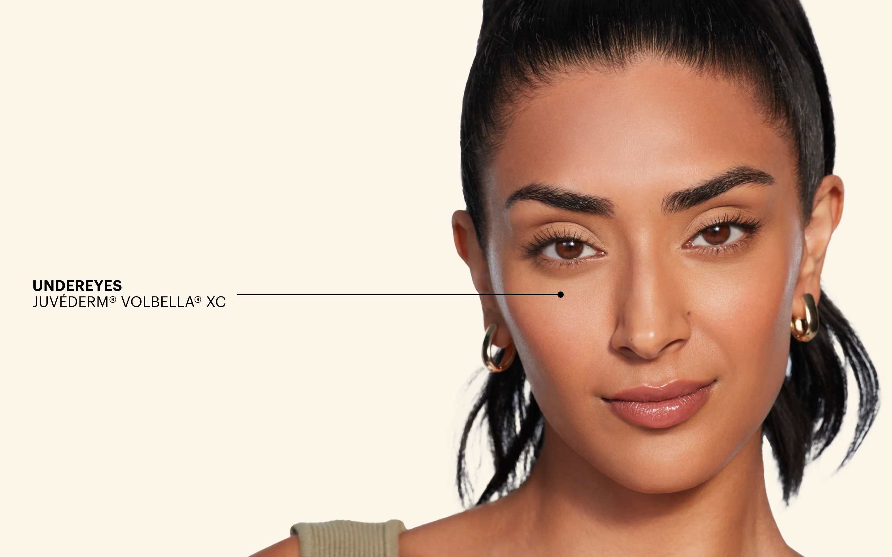 JUVÉDERM® Under-eye Filler Hero