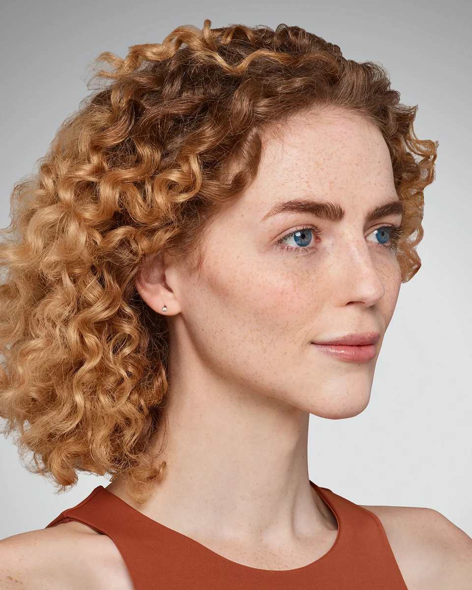 Addieson - Lips & Smile Lines After Juvederm