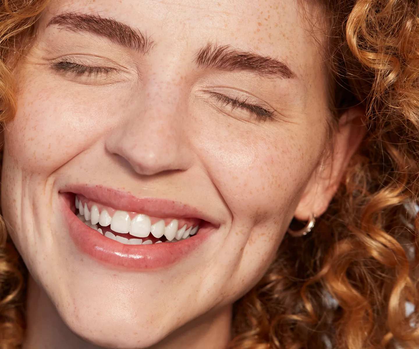 Juvederm model smiling