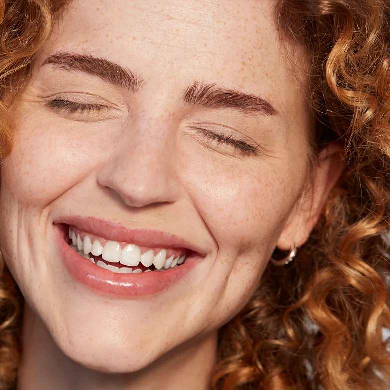 Juvederm model smiling