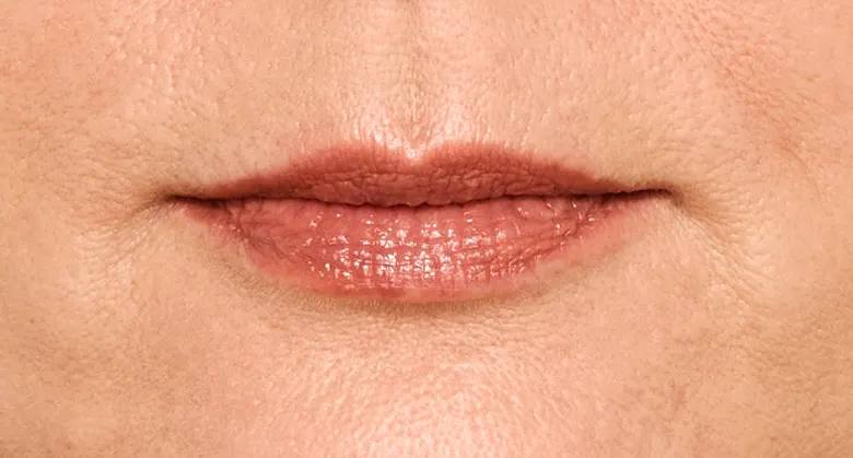 Aleksandra - Before Lip Filler