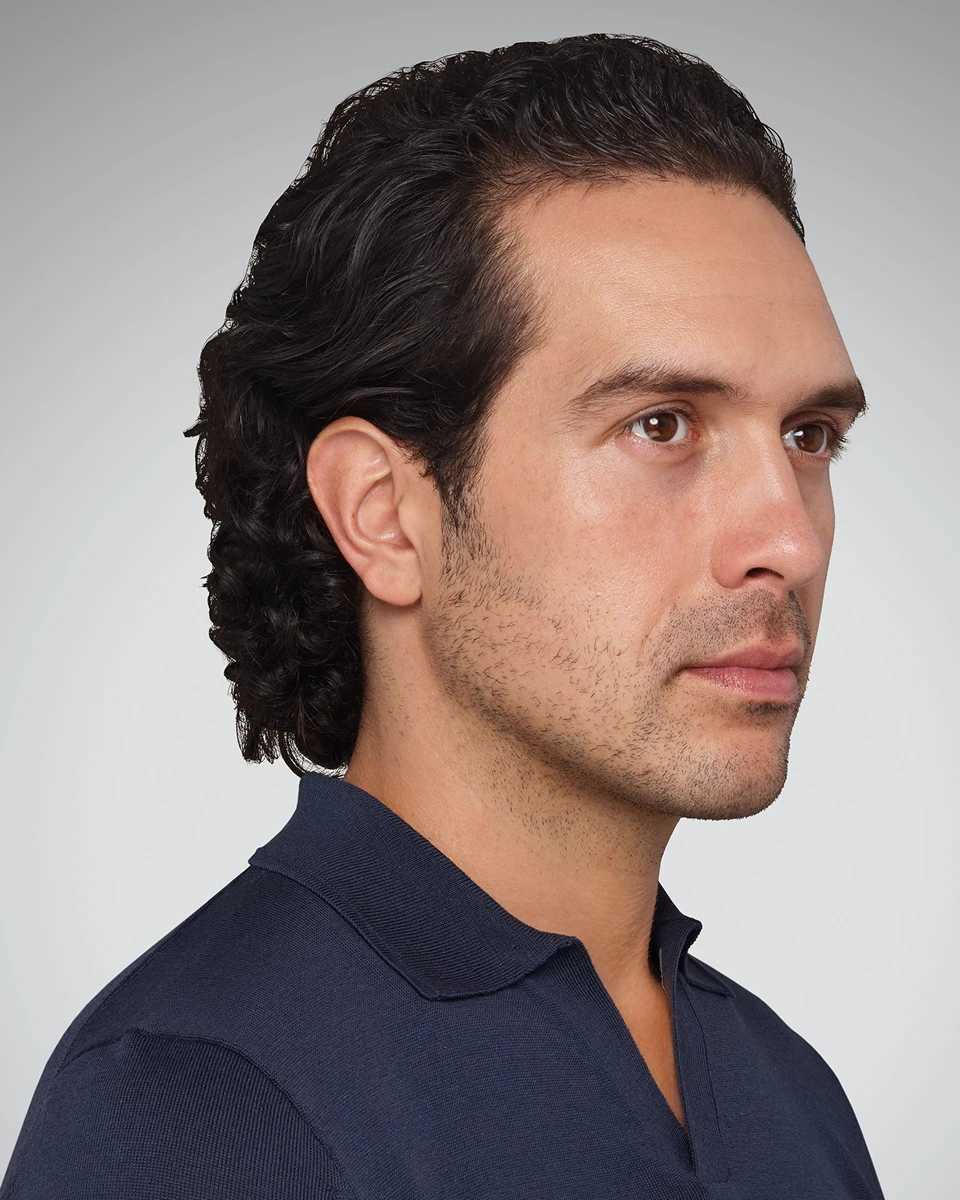 Devin - Jawline Before Juvederm