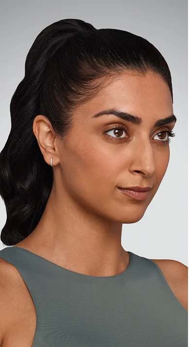 Jaskiran - Cheeks, chin, undereye, lines & lips Before Juvederm