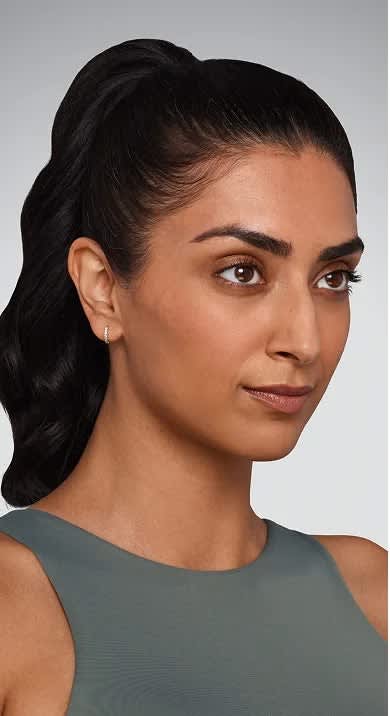 Jaskiran - Cheeks, chin, undereye, lines & lips Before Juvederm
