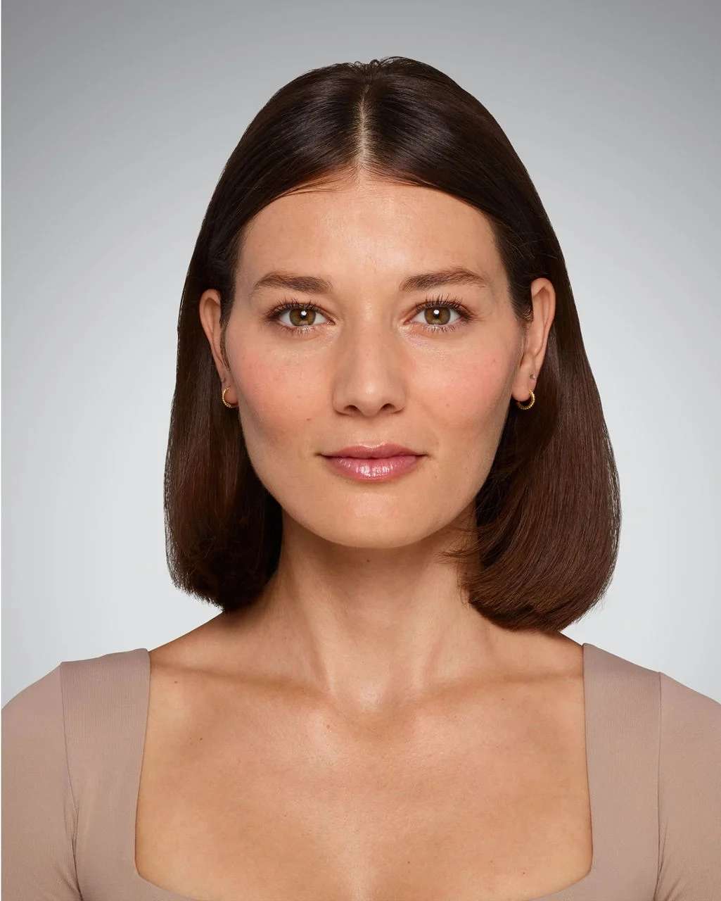 Victoria - After Lip Filler