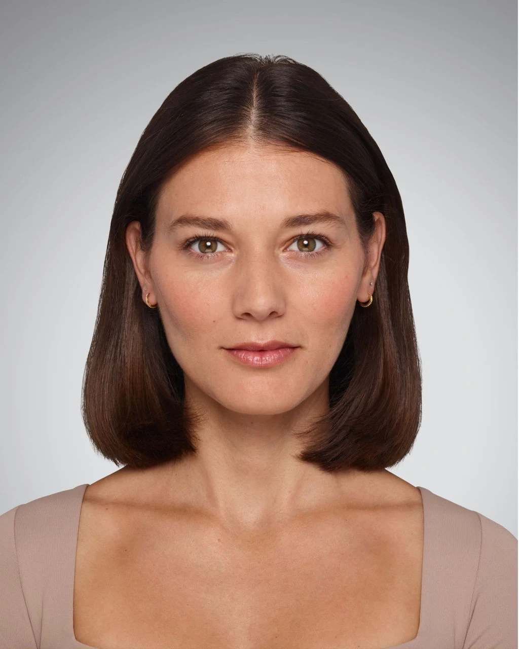 Victoria - Before Lip Filler