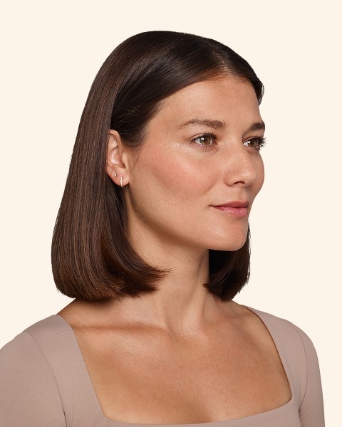 Victoria - Undereye Before Juvederm