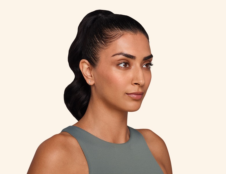 Jaskiran - Cheeks, chin, undereye, lines & lips After Juvederm