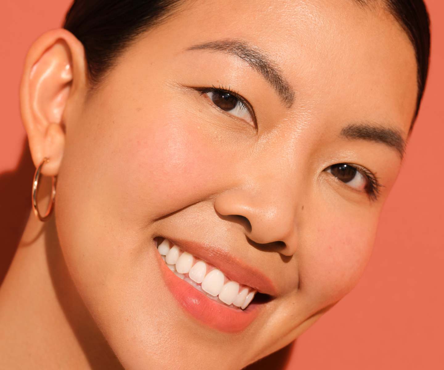 When will I see Juvederm results?