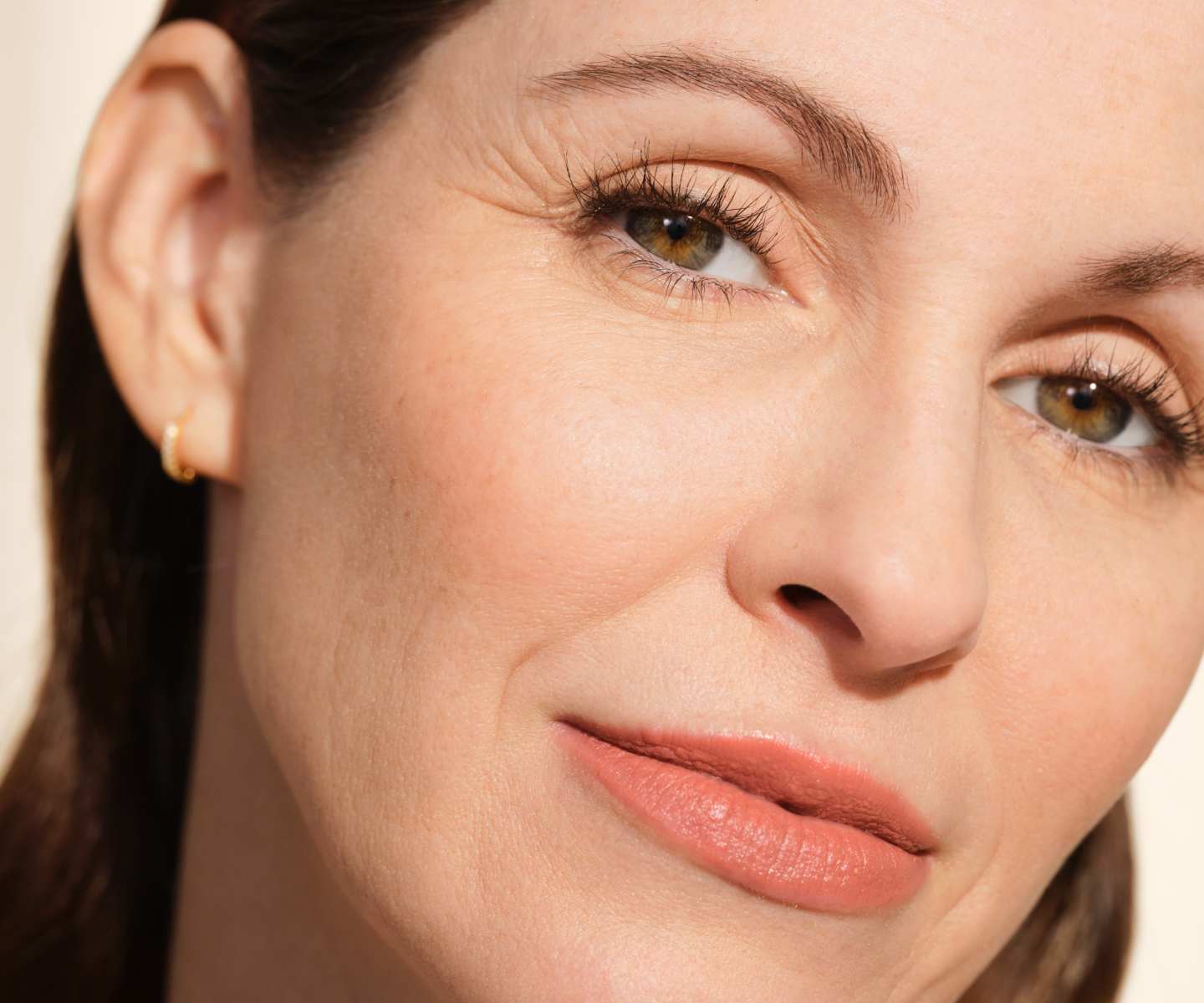 Juvederm model with freckles