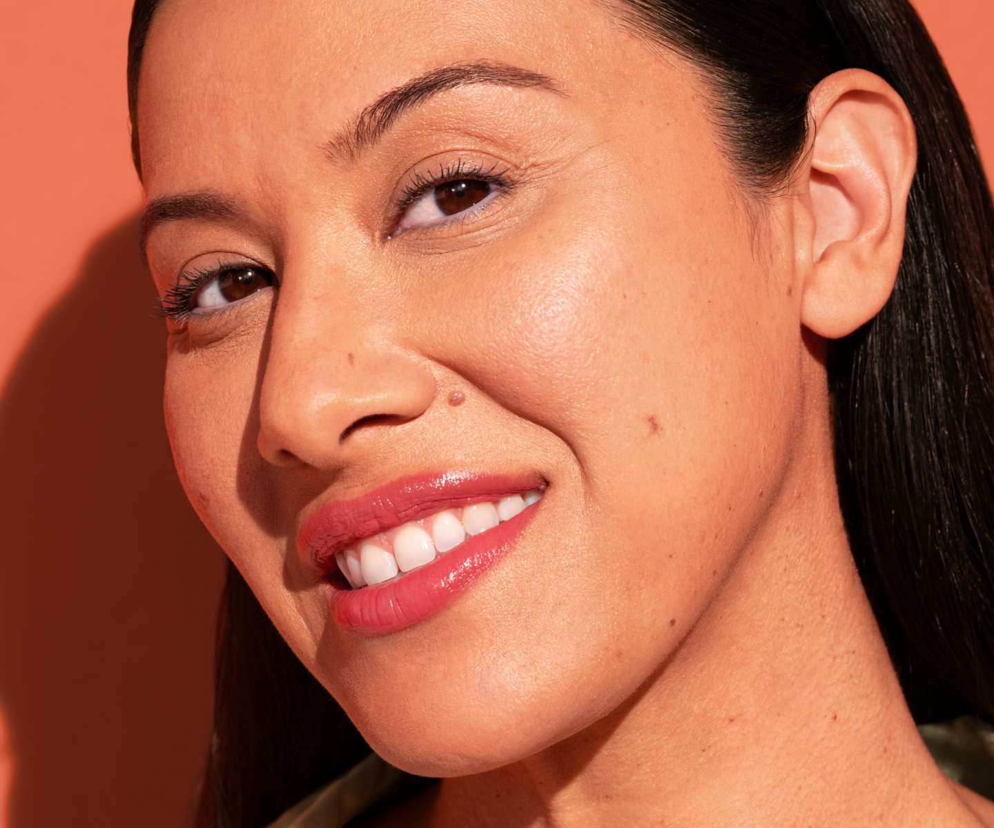 Juvederm model smiling