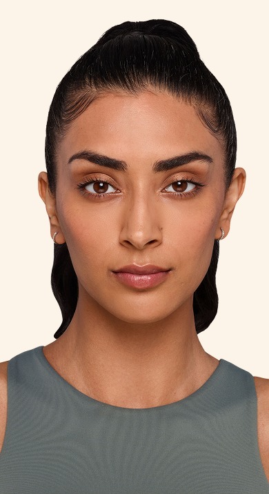 Jaskiran - Cheeks, chin, undereye, lines & lips After Juvederm
