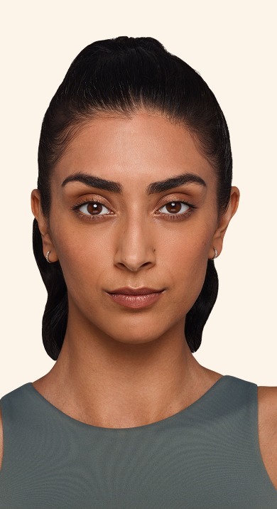 Jaskiran - Cheeks, chin, undereye, lines & lips Before Juvederm