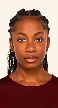 Jada - Chin Before Juvederm