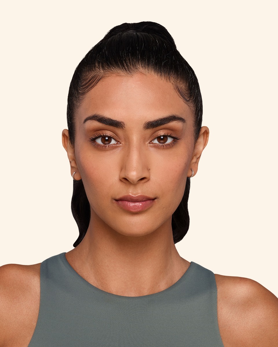 Jaskiran - Cheeks, chin, undereye, lines & lips After Juvederm