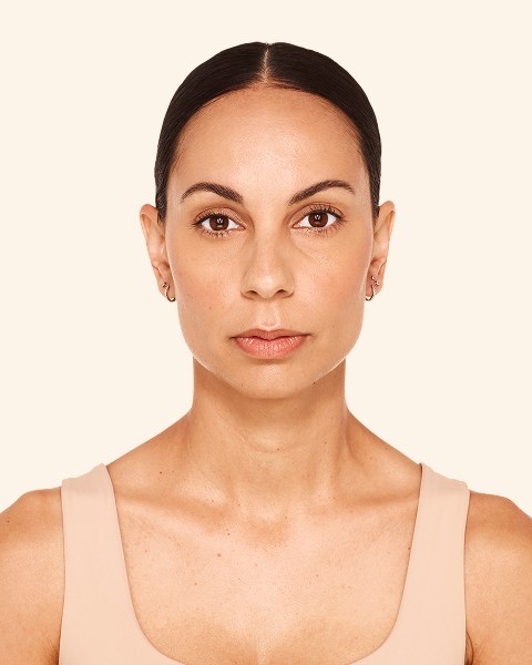 Sthefani - Before Lip Filler