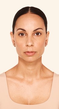 Sthefani - Before Lip Filler