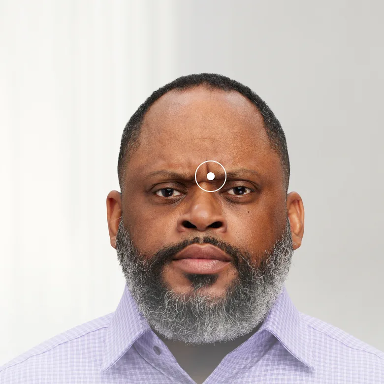 A man looking straight ahead showing the wrinkles from his frown lines