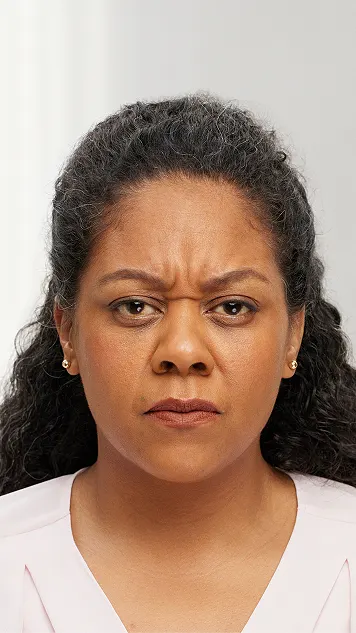 A woman's face before Botox® Cosmetic for frown lines.