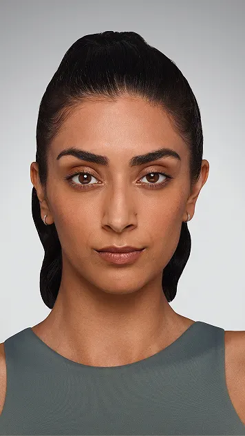 Jaskiran, a JUVÉDERM® patient, before treatment.