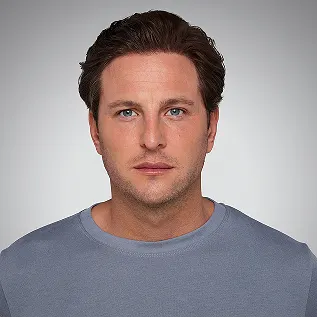 Terry, a JUVÉDERM® patient. - thumbnail 3