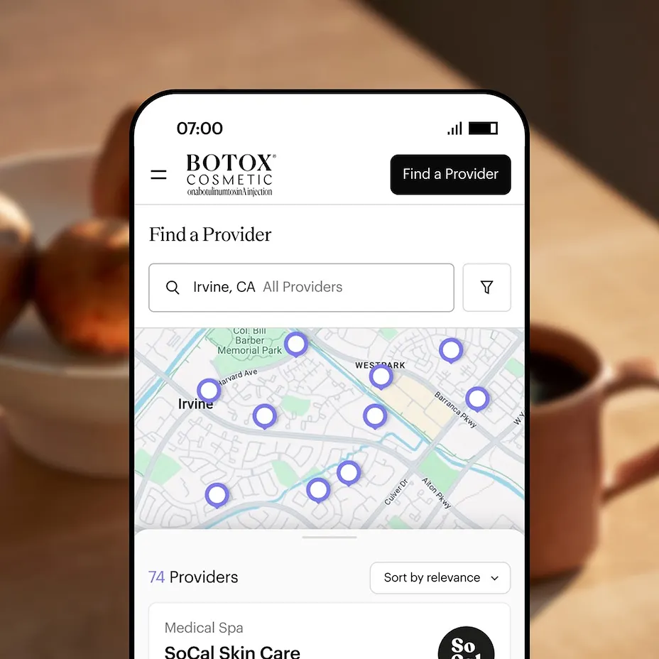 A cellphone showing a map with Allē BOTOX® providers and pins