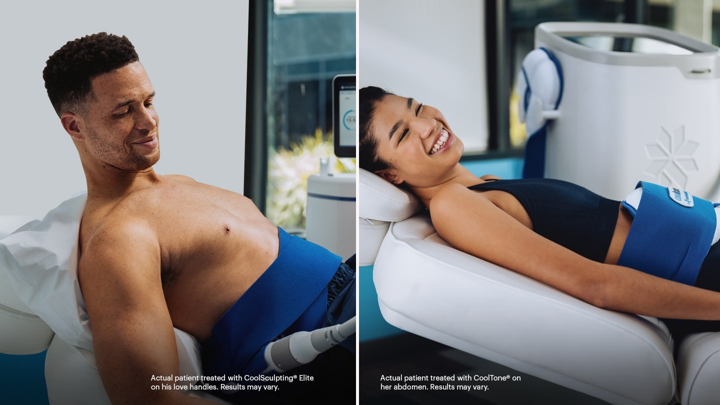 CoolSculpting® Back/Bra Roll Photo Gallery